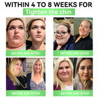 🔥Alcuras™ Moringa × Berberine × AMPK 8-Benefit Slimming & Metabolic Nano Microneedle Patch 🇺🇸  Just once a day · Visible changes in 7 days  ✅ For obesity, loose skin, diabetes, sleep apnea, joint issues, and more