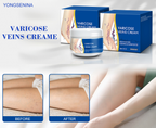 🎉Buy One Get One Free🎁 -Alcuras® Fast‑Absorbing Varicose Veins Care Cream For Smooth, Light, Confident Legs🦵