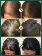 Limited Time🌿Unlock Better Hair with 70% OFF🔥Organic Rosemary Hair Growth Shampoo⚡⚡  [The less hair, the better the effect]