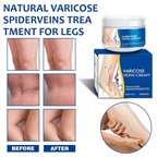 🎉Buy One Get One Free🎁 -Alcuras® Fast‑Absorbing Varicose Veins Care Cream For Smooth, Light, Confident Legs🦵