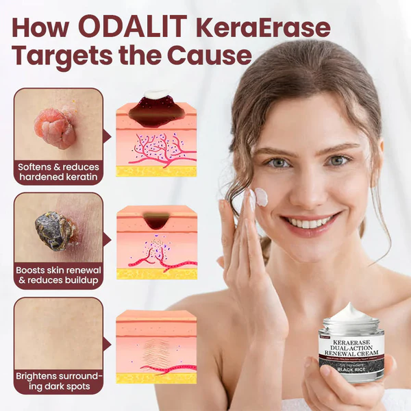 ✅Flash Sale - Alcuras® Dual-Action Renewal Cream