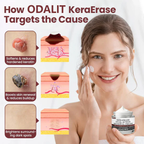 ✅Flash Sale - Alcuras® Dual-Action Renewal Cream