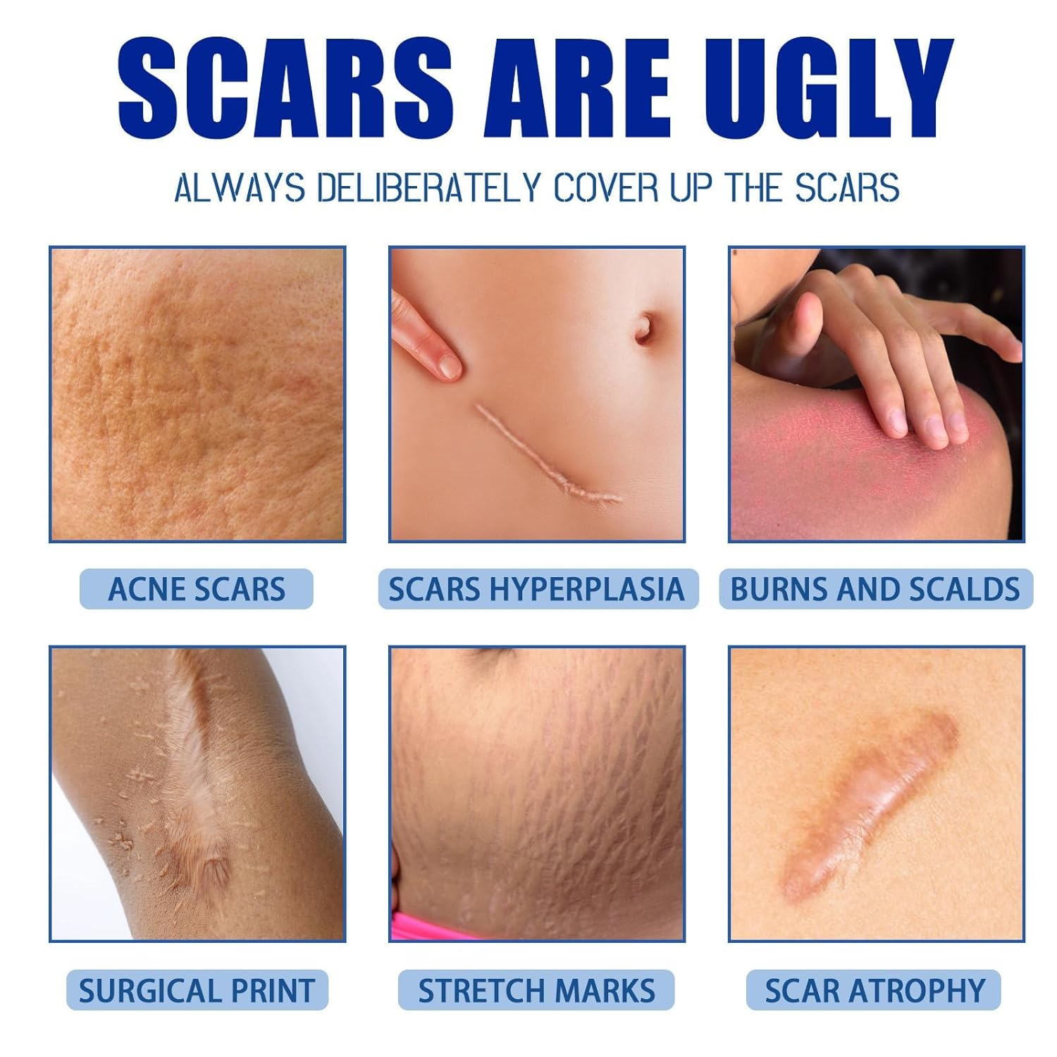 🩹 Alcuras® Medical Grade Silicone Scar Cream – Smooth Scars Fast!